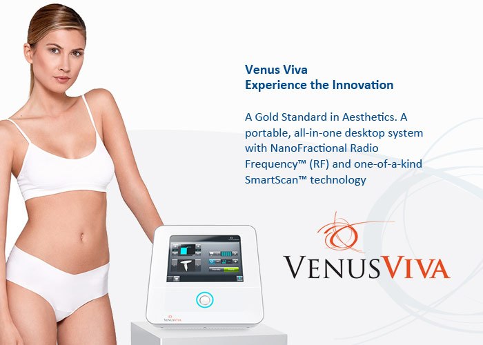 Venus Viva